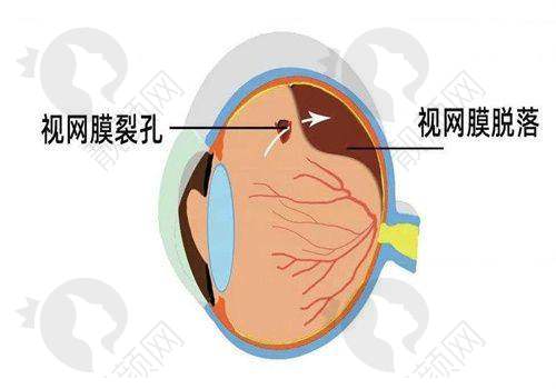 武汉爱尔眼科医院网上预约攻略